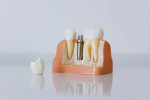Nowoczesna stomatologia we Wrocławiu – na co zwrócić uwagę przed wizytą u dentysty?